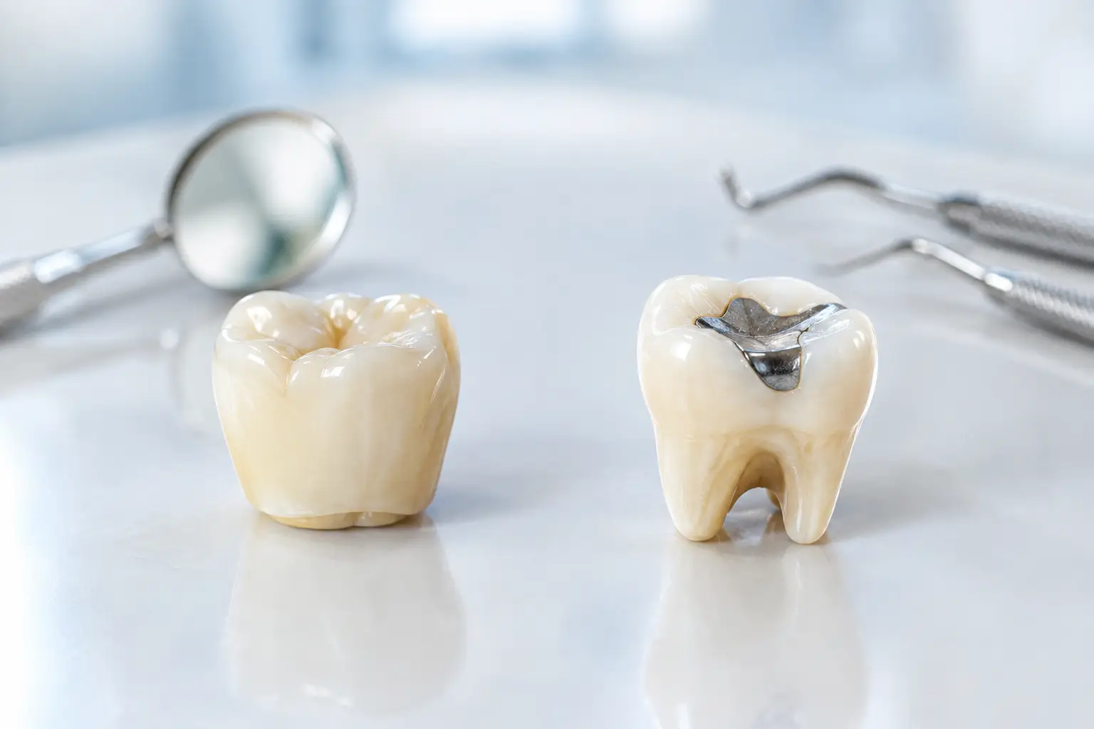 Crown Versus Dental Filling: Which Is Right?