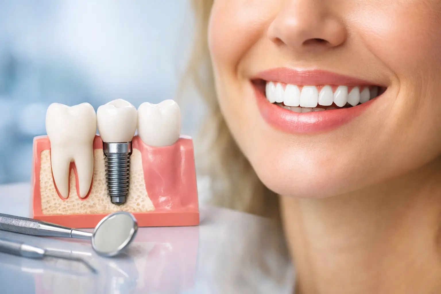 Single Tooth Implant Benefits for Your Smile